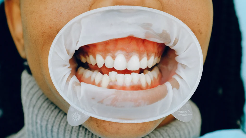 Jama ustnai i zęby u dentysty