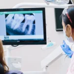 Monitor dentysta, rentgen zębów